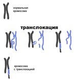 Транслокация хромосом